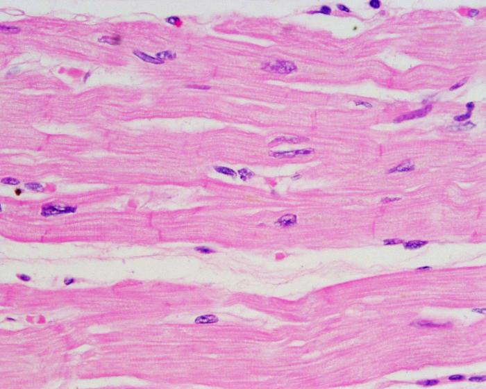 Muscle cardiac tissue cells intercalated discs histology pacemaker muscular striated quiz anatomy slides characteristic heart system muscles quizlet body nervous